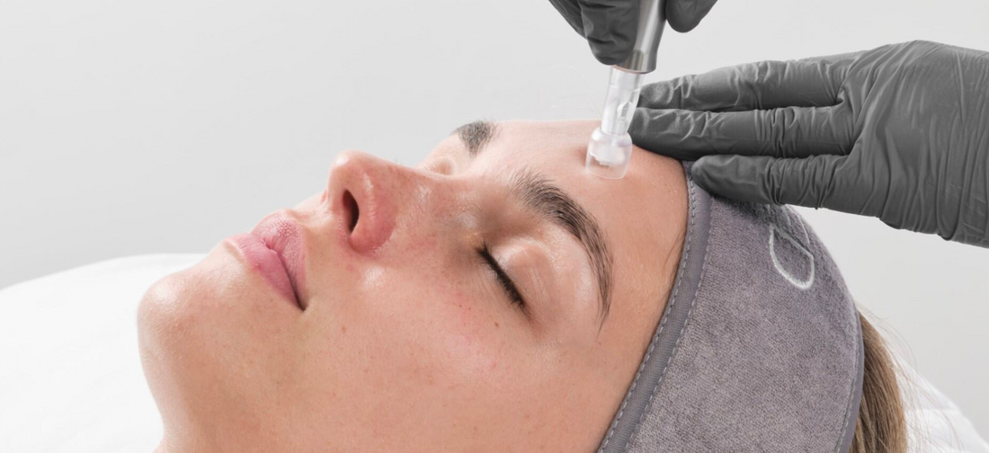 Micro-Magic – Treating Pigmentation with Medical Microneedling